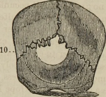 An illustration from The illustrated self-instructor in phrenology and physiology : with over one hundred engravings : together with the chart and character of ... as marked by ..., 1859, leaf 106