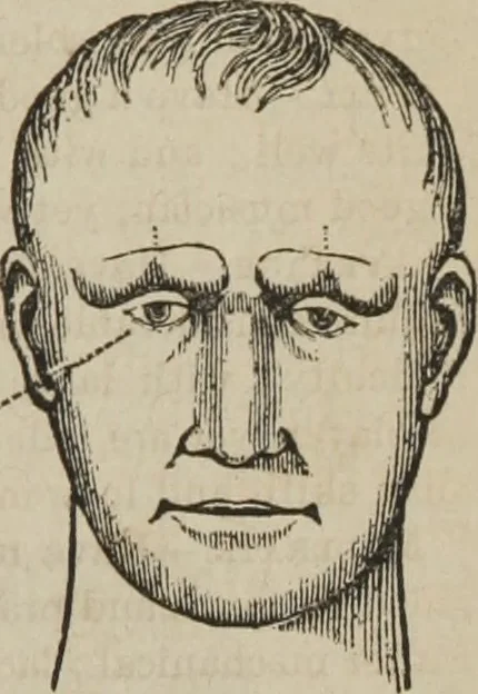 An illustration from The illustrated self-instructor in phrenology and physiology : with over one hundred engravings : together with the chart and character of ... as marked by ..., 1859, leaf 160
