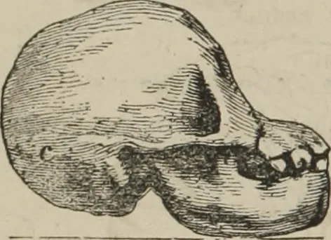 An illustration from The illustrated self-instructor in phrenology and physiology : with over one hundred engravings : together with the chart and character of ... as marked by ..., 1859, leaf 67