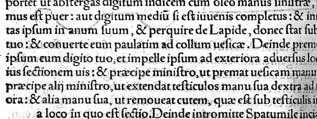 An illustration from Octavii Horatiani Rerum medicarum libri quatuor. I Logicus, de curationibus omnium ferme morborum corporis humani... II. De acutis et chronicis passionibus... III. Gynecia, de mulierum accidentibus et curis eorumdem... IV. De physica scientia, experimentorum liber. Per Heremanum comitem a Neuenar, integro candori nuper restitutus autor. Albucasis,... Libri tres I. De cauterio cum igne et medicinis acutis per singula corporis humani membro... II. De sectione et perforatione phlebotomia, et ventosis ; de vulneribus et extractione sagittarum... III. De restauratione et curatione dislocationis membrorum..., 1532, leaf 211