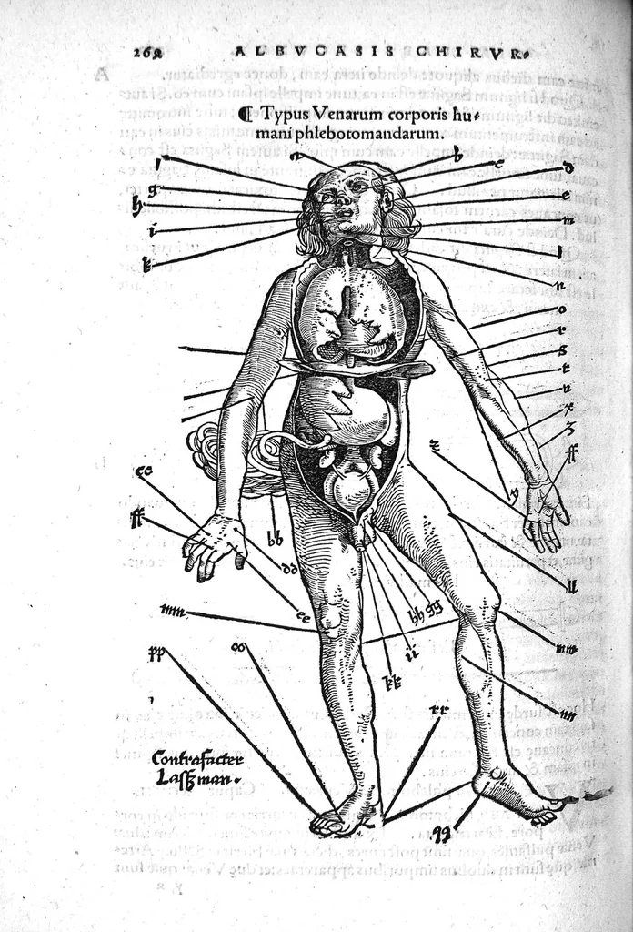 An illustration from Octavii Horatiani Rerum medicarum libri quatuor. I Logicus, de curationibus omnium ferme morborum corporis humani... II. De acutis et chronicis passionibus... III. Gynecia, de mulierum accidentibus et curis eorumdem... IV. De physica scientia, experimentorum liber. Per Heremanum comitem a Neuenar, integro candori nuper restitutus autor. Albucasis,... Libri tres I. De cauterio cum igne et medicinis acutis per singula corporis humani membro... II. De sectione et perforatione phlebotomia, et ventosis ; de vulneribus et extractione sagittarum... III. De restauratione et curatione dislocationis membrorum..., 1532, leaf 267