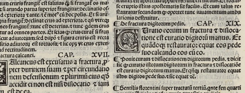 An illustration from Comm. Avicenne Canon IV 3-5, leaf 294