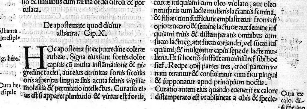 An illustration from Liber theoricae necnon practicae Alsaharavii in prisco Arabum Medicorum conventu facile principis..., 1519, leaf 68