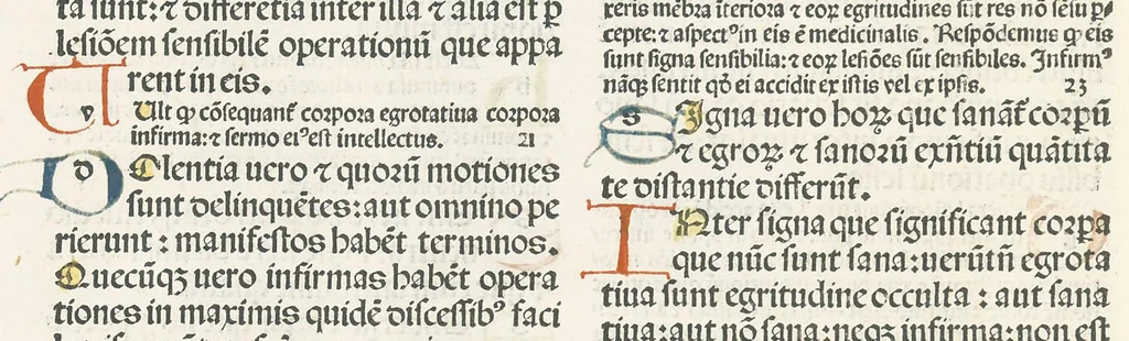 An illustration from [Articella], leaf 325