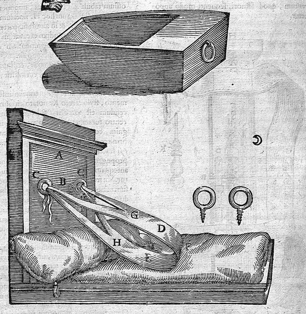 An illustration from Opera observationum et curationum medico-chirurgicarum, quae exstant omnia, 1682, leaf 488