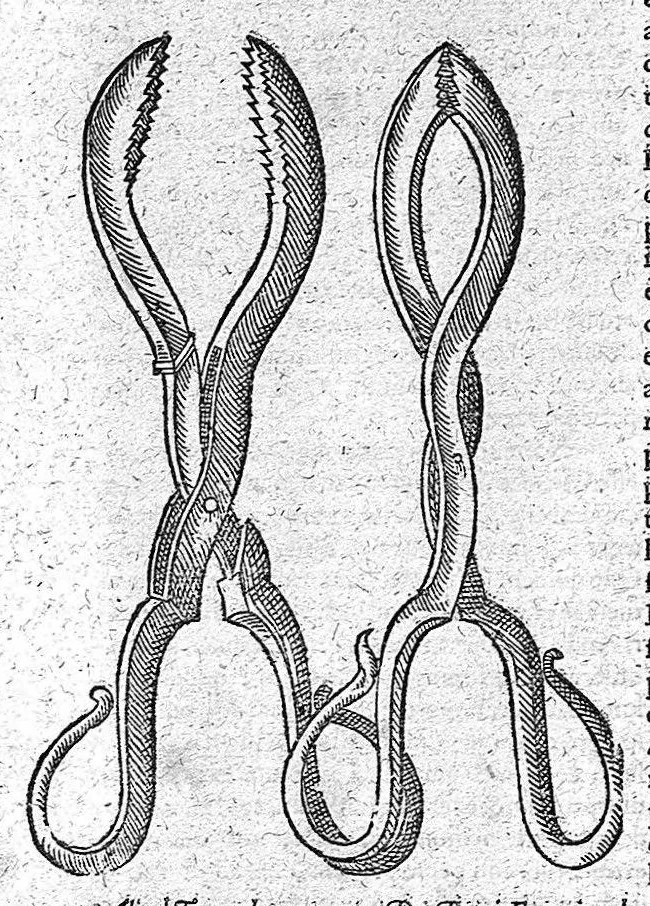 An illustration from Opera observationum et curationum medico-chirurgicarum, quae exstant omnia, 1682, leaf 738