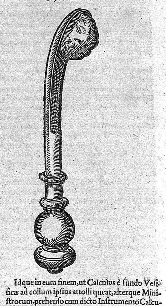 An illustration from Opera observationum et curationum medico-chirurgicarum, quae exstant omnia, 1682, leaf 749