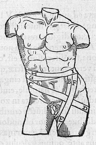 An illustration from Chirurgia è graeco in latinum conversa, Vido Vidio Florentino interprete, cum nonnullis ejusdem Vidii co[m]mentariis, 1544, leaf 492
