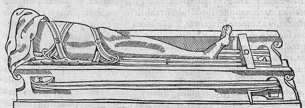 An illustration from Chirurgia è graeco in latinum conversa, Vido Vidio Florentino interprete, cum nonnullis ejusdem Vidii co[m]mentariis, 1544, leaf 517