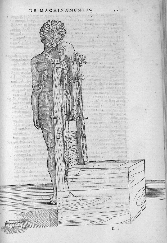 An illustration from Chirurgia è graeco in latinum conversa, Vido Vidio Florentino interprete, cum nonnullis ejusdem Vidii co[m]mentariis, 1544, leaf 550