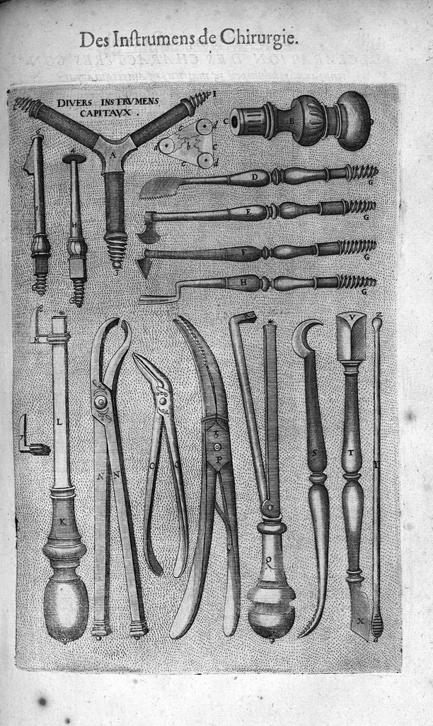 An illustration from Les Oeuvres de chirurgie de Jacques Guillemeau, chirurgien ordinaire du Roy et Juré à paris, divisées en treize livres. Avec les Portraicts & Figures Anatomiques de toutes les parties du corps humain. Et des Instrumens necessaires au Chirurgien. Derniere edition, 1602, leaf 162