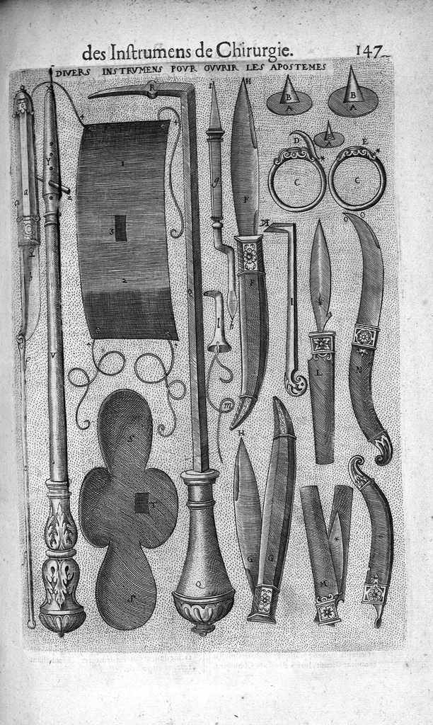 An illustration from Les Oeuvres de chirurgie de Jacques Guillemeau, chirurgien ordinaire du Roy et Juré à paris, divisées en treize livres. Avec les Portraicts & Figures Anatomiques de toutes les parties du corps humain. Et des Instrumens necessaires au Chirurgien. Derniere edition, 1602, leaf 172