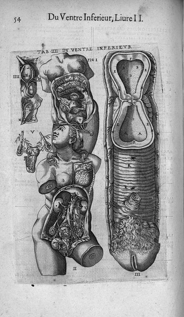 An illustration from Les Oeuvres de chirurgie de Jacques Guillemeau, chirurgien ordinaire du Roy et Juré à paris, divisées en treize livres. Avec les Portraicts & Figures Anatomiques de toutes les parties du corps humain. Et des Instrumens necessaires au Chirurgien. Derniere edition, 1602, leaf 67