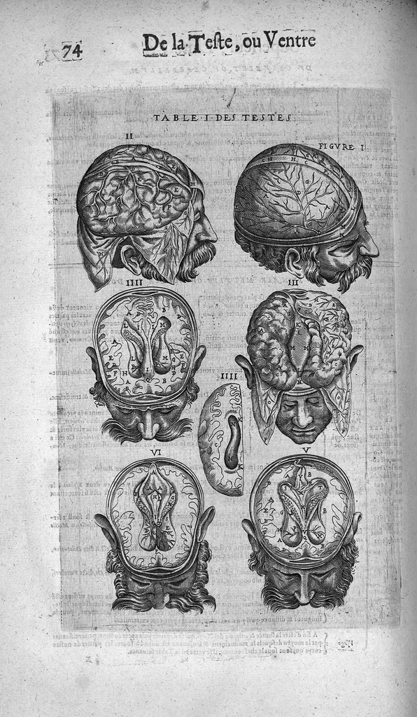 An illustration from Les Oeuvres de chirurgie de Jacques Guillemeau, chirurgien ordinaire du Roy et Juré à paris, divisées en treize livres. Avec les Portraicts & Figures Anatomiques de toutes les parties du corps humain. Et des Instrumens necessaires au Chirurgien. Derniere edition, 1602, leaf 87