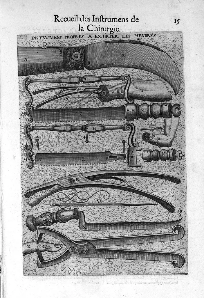 An illustration from La chirurgie françoise, recueillie des Anciens Medecins et Chirurgiens avec plusieurs figures des Instrumens necesseres pour l’operation Manuelle par Jacques Guillemeau D’Orleans, Chirurgien du Roy et Juré a Paris, 1594, leaf 22