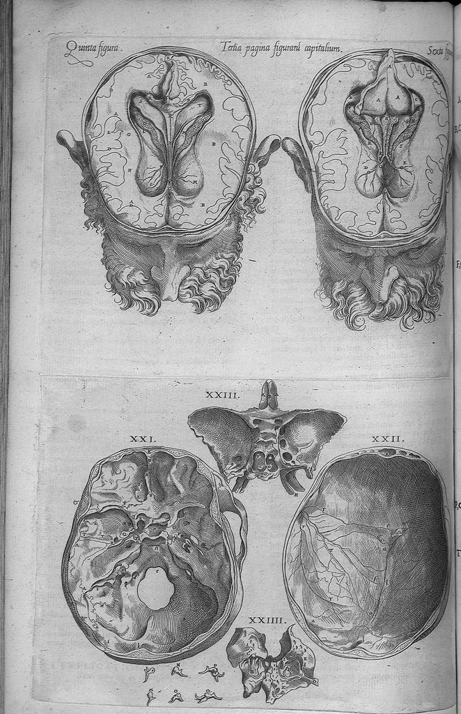 An illustration from Les portraits anatomiques de toutes les parties du corps humain, gravez en taille douce, par le commandement de feu Henry huictiesme, Roy d’Angleterre. Ensemble l’Abbregé d’André Vesal, et l’explication d’iceux, accompagnee d’une declaration Anatomique. Par Jaques Grevin, de Clermont en Beauvoisis, Medecin à Paris,, 1569, leaf 145