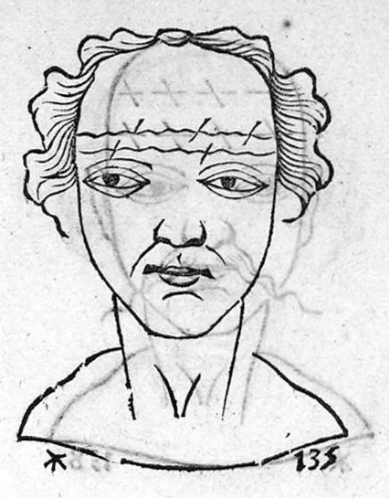 An illustration from Metoposcopia liber tredecim, et octingentis faciei humanae eiconibus complexa : cui accessit melampodis de naevis corporis tractatus, graece et latine nunc primum editus, 1658, leaf 100
