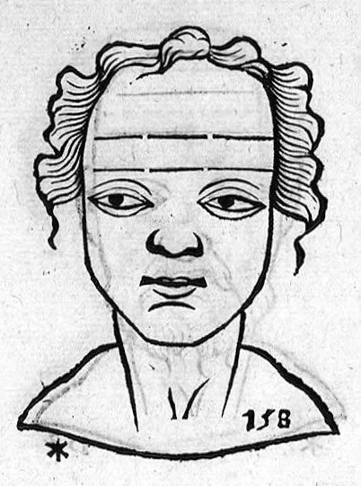 An illustration from Metoposcopia liber tredecim, et octingentis faciei humanae eiconibus complexa : cui accessit melampodis de naevis corporis tractatus, graece et latine nunc primum editus, 1658, leaf 107