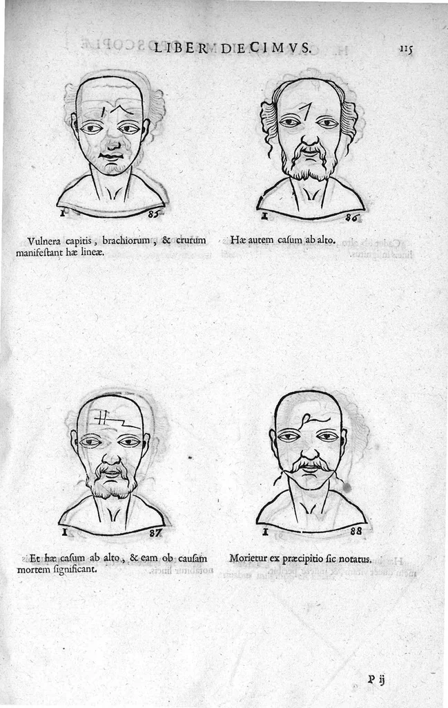 An illustration from Metoposcopia liber tredecim, et octingentis faciei humanae eiconibus complexa : cui accessit melampodis de naevis corporis tractatus, graece et latine nunc primum editus, 1658, leaf 130