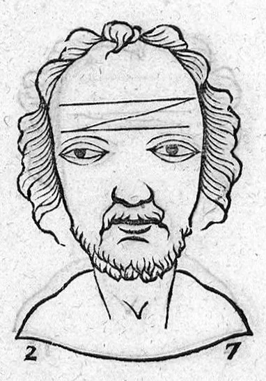 An illustration from Metoposcopia liber tredecim, et octingentis faciei humanae eiconibus complexa : cui accessit melampodis de naevis corporis tractatus, graece et latine nunc primum editus, 1658, leaf 160