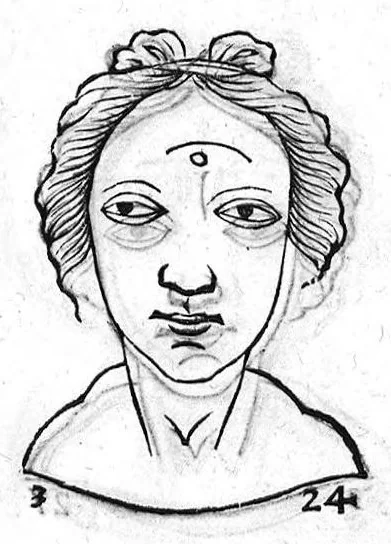 An illustration from Metoposcopia liber tredecim, et octingentis faciei humanae eiconibus complexa : cui accessit melampodis de naevis corporis tractatus, graece et latine nunc primum editus, 1658, leaf 174