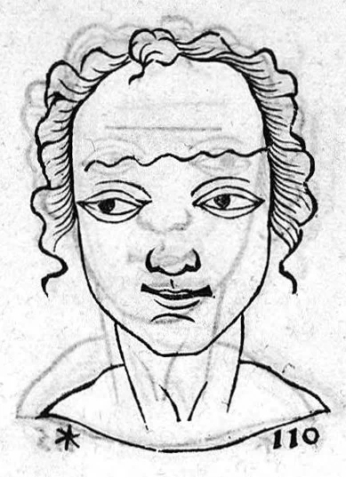 An illustration from Metoposcopia liber tredecim, et octingentis faciei humanae eiconibus complexa : cui accessit melampodis de naevis corporis tractatus, graece et latine nunc primum editus, 1658, leaf 94