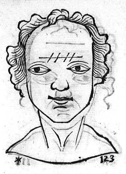 An illustration from Metoposcopia liber tredecim, et octingentis faciei humanae eiconibus complexa : cui accessit melampodis de naevis corporis tractatus, graece et latine nunc primum editus, 1658, leaf 97