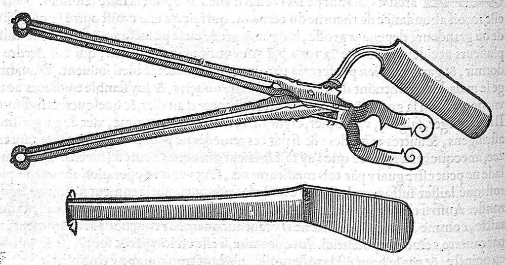 An illustration from Les Oeuvres d'Ambroise Paré,... divisées en vingt huict livres avec les figures et portraicts, tant de l'anatomie que des instruments de chirurgie, et de plusieurs monstres, reveuës et augmentées par l'autheur. Quatriesme Edition., 1585, leaf 326