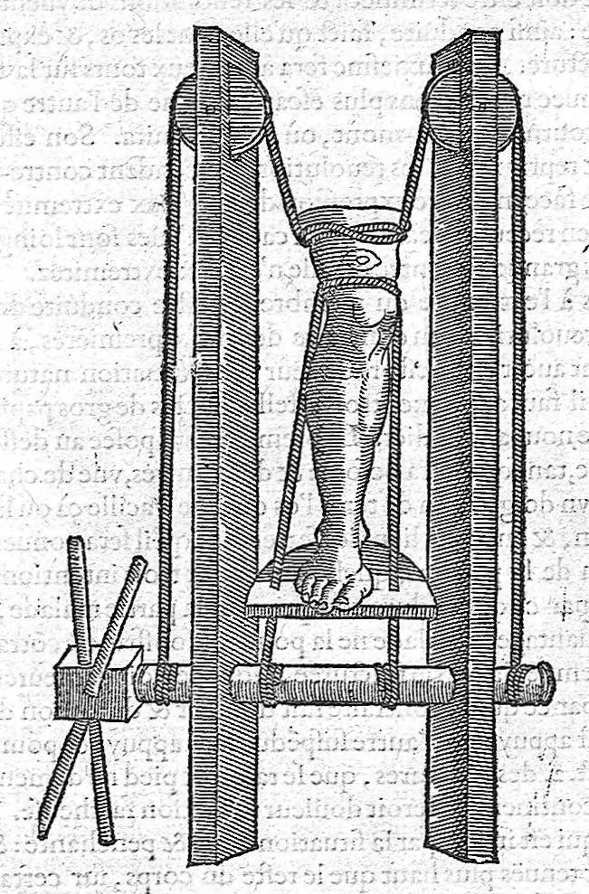 An illustration from Les Oeuvres d'Ambroise Paré,... divisées en vingt huict livres avec les figures et portraicts, tant de l'anatomie que des instruments de chirurgie, et de plusieurs monstres, reveuës et augmentées par l'autheur. Quatriesme Edition., 1585, leaf 569
