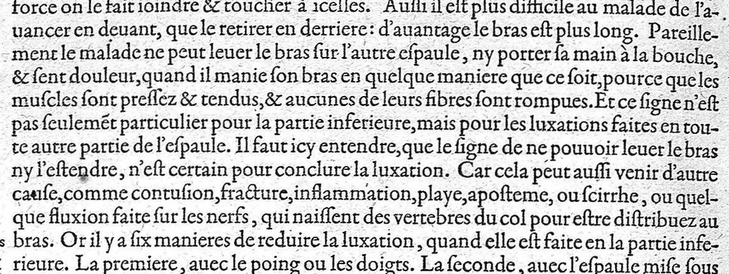 An illustration from Les Oeuvres d'Ambroise Paré,... divisées en vingt huict livres avec les figures et portraicts, tant de l'anatomie que des instruments de chirurgie, et de plusieurs monstres, reveuës et augmentées par l'autheur. Quatriesme Edition., 1585, leaf 598