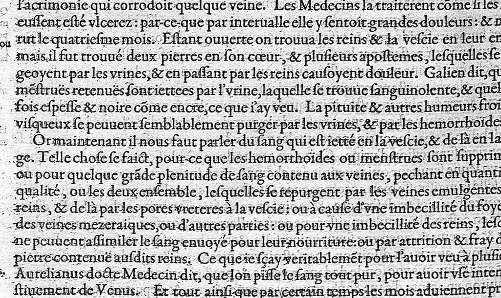 An illustration from Les Oeuvres d'Ambroise Paré,... divisées en vingt huict livres avec les figures et portraicts, tant de l'anatomie que des instruments de chirurgie, et de plusieurs monstres, reveuës et augmentées par l'autheur. Quatriesme Edition., 1585, leaf 676