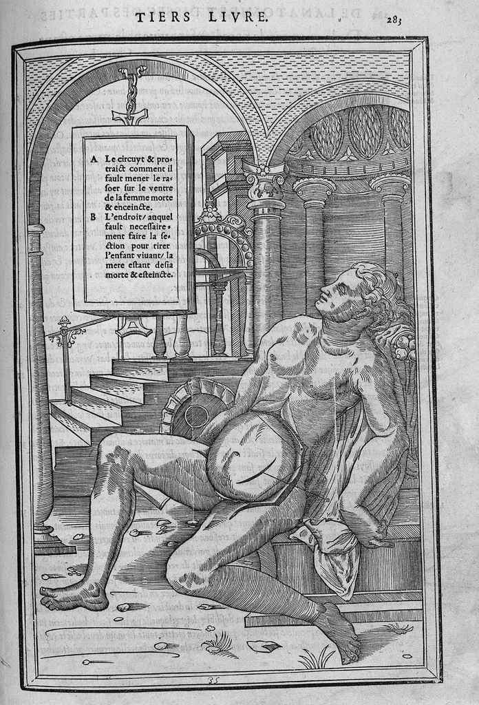 An illustration from La dissection des parties du corps humain divisee en trois livres, faictz par Charles Estienne, docteur en Medecine : avec les figures et declaration des incisions, composees par Estienne de la Riviere Chirurgien,, 1546, leaf 298
