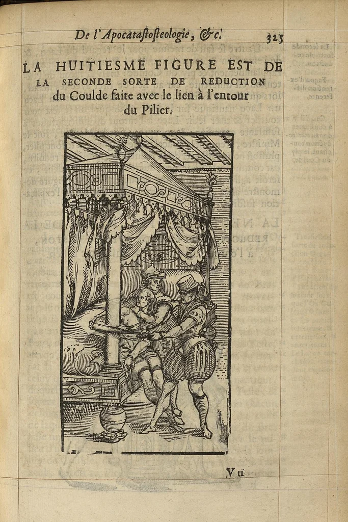 An illustration from L'Oeconomie chirurgicale, pour le r'habillement des os du corps humain contenant l'ostéologie, la nososreologie, l'apocatastosteologie, & le Traitté des bandages, 1671, leaf 353