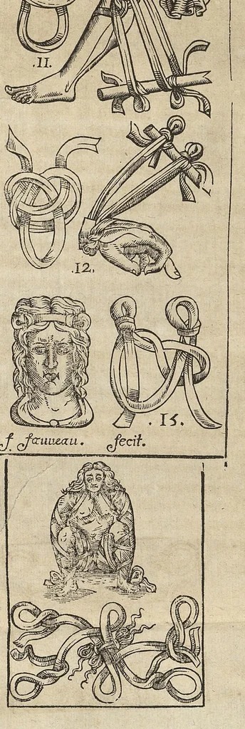 An illustration from L'Oeconomie chirurgicale, pour le r'habillement des os du corps humain contenant l'ostéologie, la nososreologie, l'apocatastosteologie, & le Traitté des bandages, 1671, leaf 400