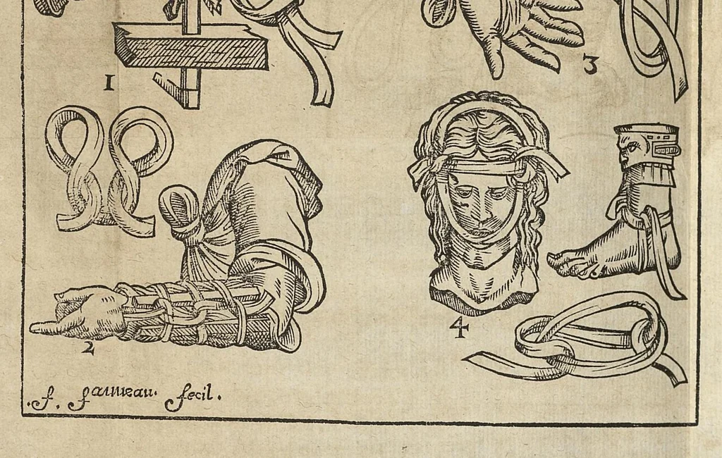 An illustration from L'Oeconomie chirurgicale, pour le r'habillement des os du corps humain contenant l'ostéologie, la nososreologie, l'apocatastosteologie, & le Traitté des bandages, 1671, leaf 400
