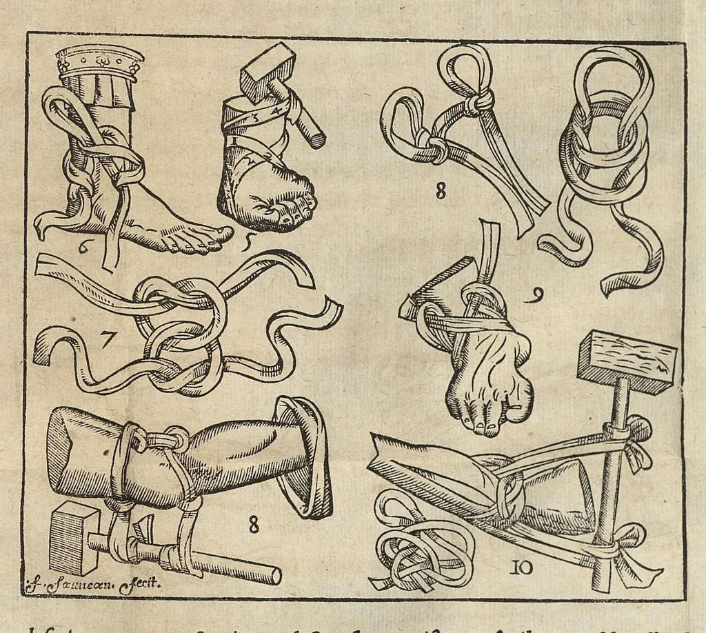 An illustration from L'Oeconomie chirurgicale, pour le r'habillement des os du corps humain contenant l'ostéologie, la nososreologie, l'apocatastosteologie, & le Traitté des bandages, 1671, leaf 400