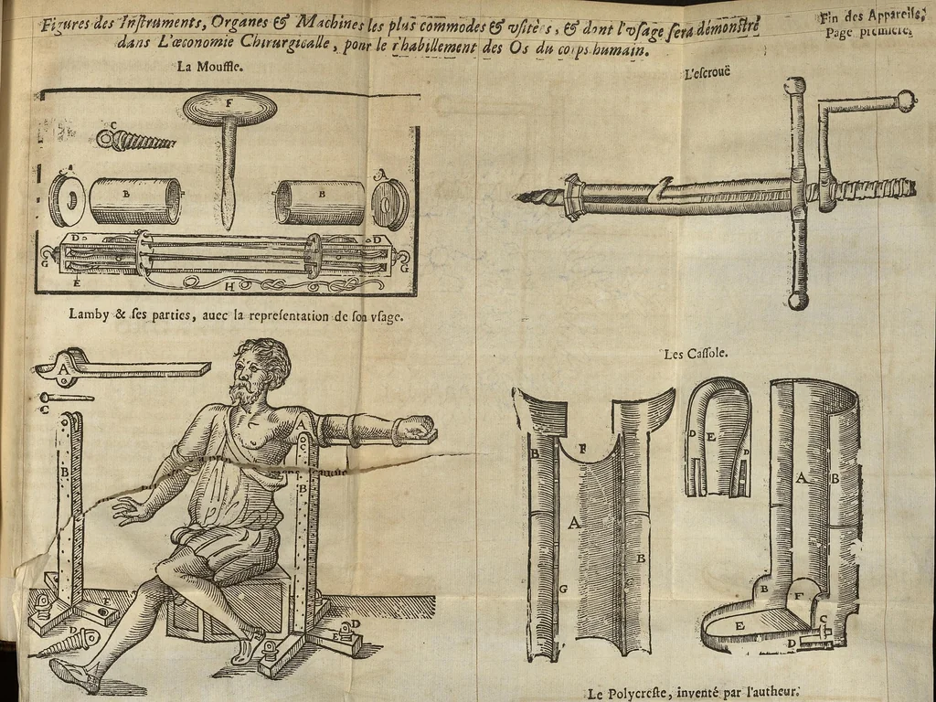 An illustration from L'Oeconomie chirurgicale, pour le r'habillement des os du corps humain contenant l'ostéologie, la nososreologie, l'apocatastosteologie, & le Traitté des bandages, 1671, leaf 410