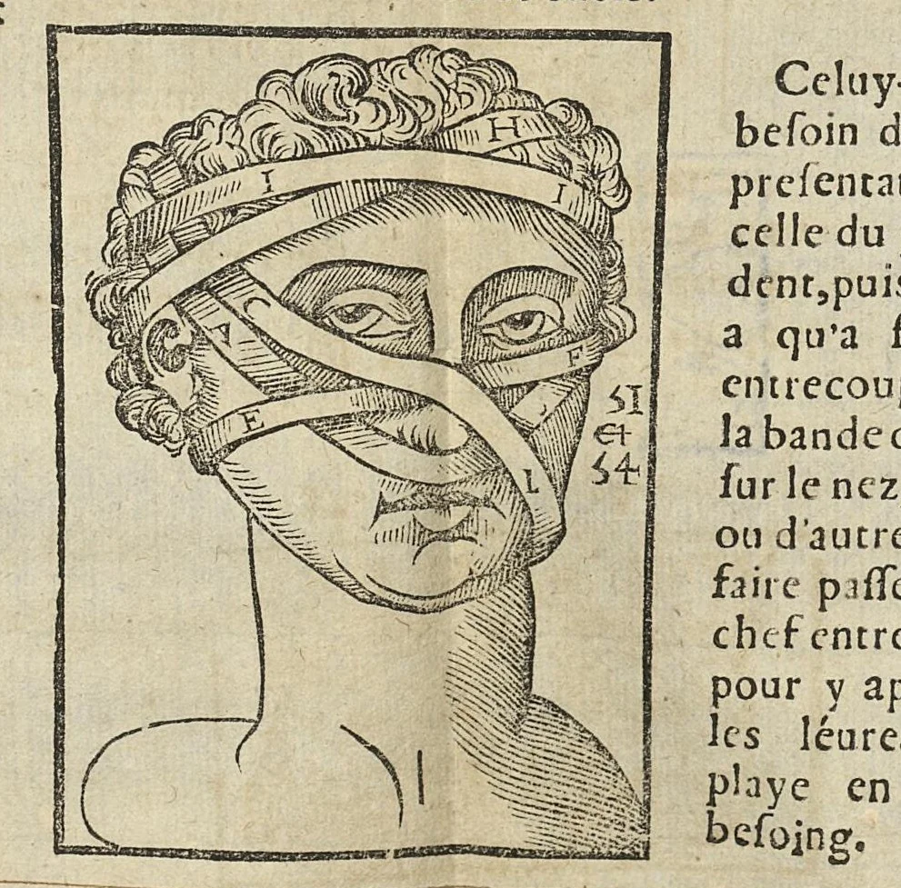 An illustration from L'Oeconomie chirurgicale, pour le r'habillement des os du corps humain contenant l'ostéologie, la nososreologie, l'apocatastosteologie, & le Traitté des bandages, 1671, leaf 431