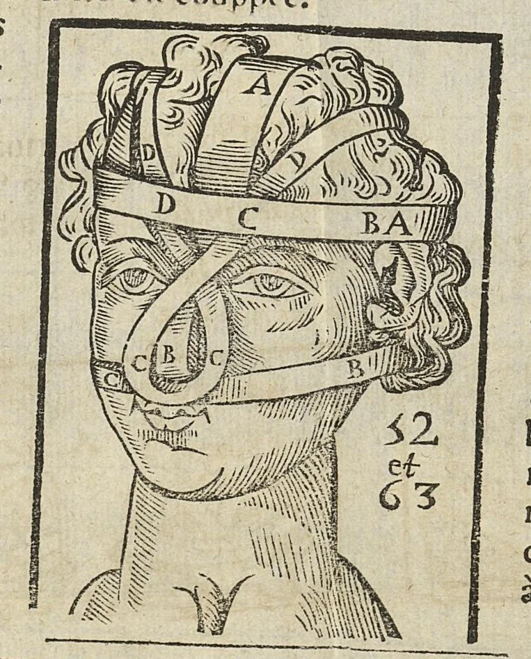 An illustration from L'Oeconomie chirurgicale, pour le r'habillement des os du corps humain contenant l'ostéologie, la nososreologie, l'apocatastosteologie, & le Traitté des bandages, 1671, leaf 431