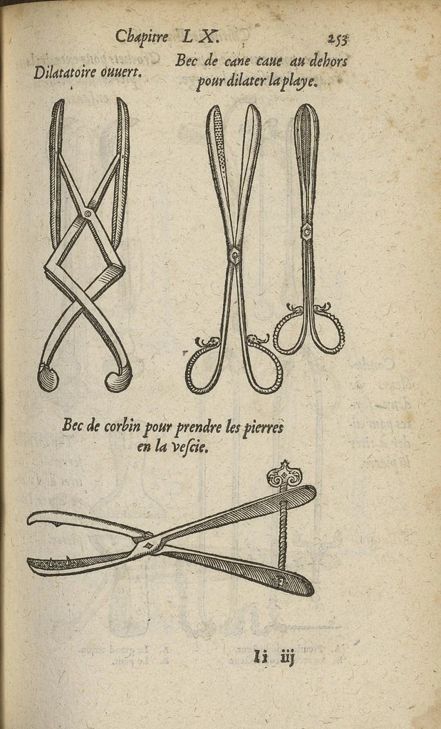 An illustration from Chirurgie françoise ... avec plusieurs figures des instrumens nécessaires pour l'opération manuelle, 1610, leaf 278