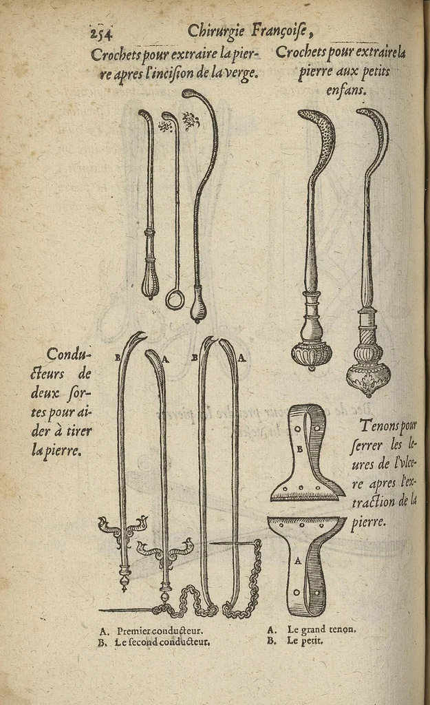 An illustration from Chirurgie françoise ... avec plusieurs figures des instrumens nécessaires pour l'opération manuelle, 1610, leaf 279
