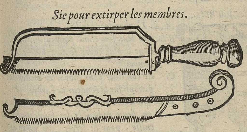 An illustration from Chirurgie françoise ... avec plusieurs figures des instrumens nécessaires pour l'opération manuelle, 1610, leaf 420