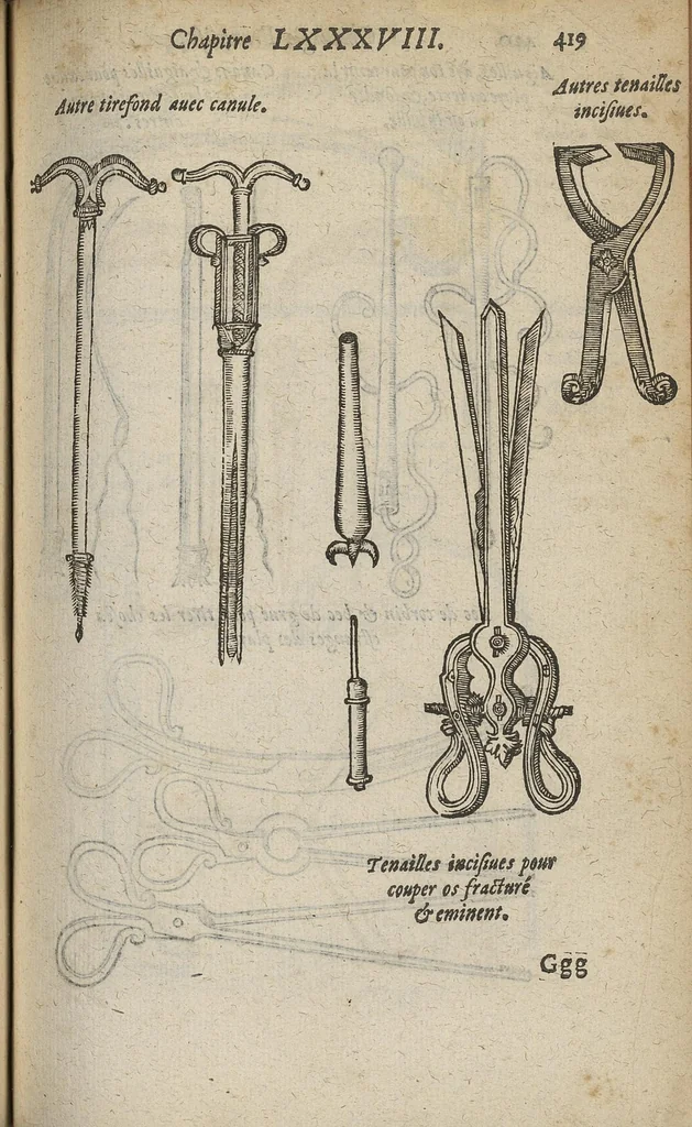 An illustration from Chirurgie françoise ... avec plusieurs figures des instrumens nécessaires pour l'opération manuelle, 1610, leaf 442