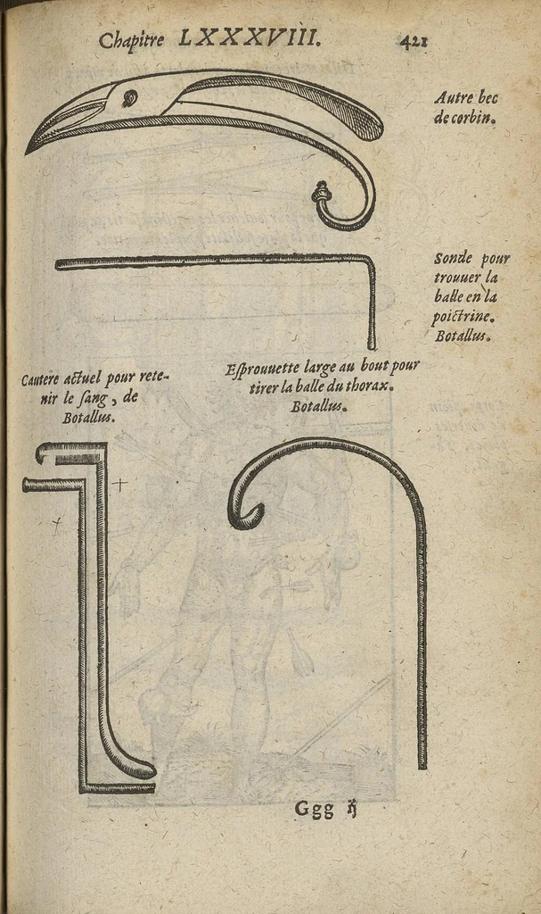 An illustration from Chirurgie françoise ... avec plusieurs figures des instrumens nécessaires pour l'opération manuelle, 1610, leaf 444