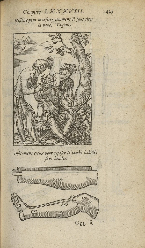 An illustration from Chirurgie françoise ... avec plusieurs figures des instrumens nécessaires pour l'opération manuelle, 1610, leaf 446