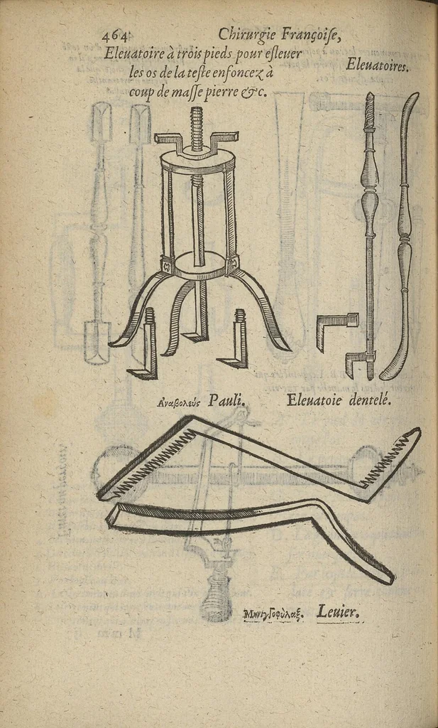 An illustration from Chirurgie françoise ... avec plusieurs figures des instrumens nécessaires pour l'opération manuelle, 1610, leaf 485