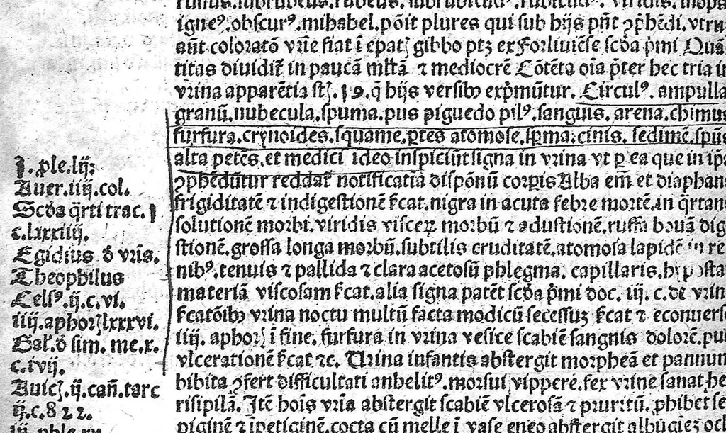 An illustration from Antropologium de hominis dignitate, natura, et proprietatibus; de elementis, partibus et membris humani corporis..., 1501, leaf 215