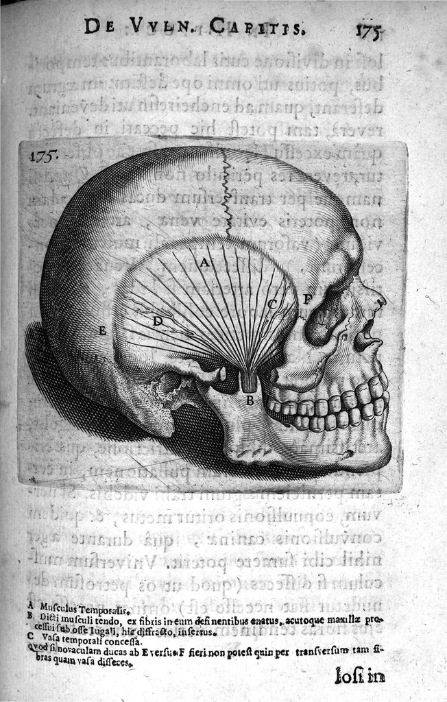 An illustration from Petri Paaw Amsteldamensis Succenturiatus Anatomicus. continens Commentaria in Hippocratem, de Capitis Vulneribus. additae In aliquot Capita libri VIII C. Celsi Explicationes. Ad illustres, Nobiles, Praepotentes, ac verè Magnifices Hollandiae Westfrisiaeque Ordines., 1616, leaf 184