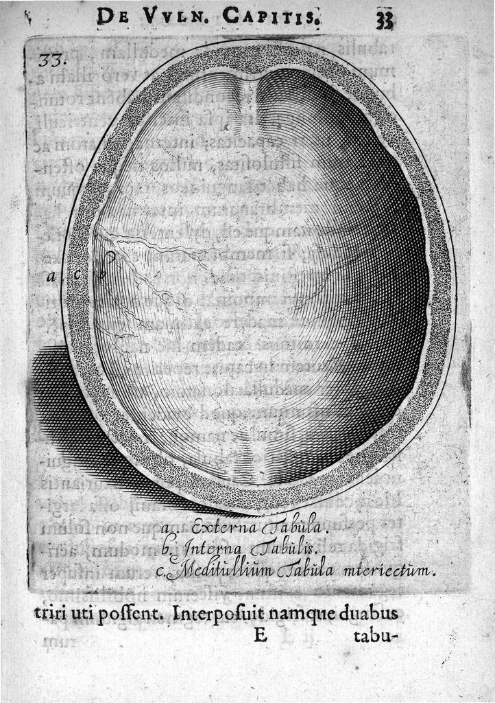 An illustration from Petri Paaw Amsteldamensis Succenturiatus Anatomicus. continens Commentaria in Hippocratem, de Capitis Vulneribus. additae In aliquot Capita libri VIII C. Celsi Explicationes. Ad illustres, Nobiles, Praepotentes, ac verè Magnifices Hollandiae Westfrisiaeque Ordines., 1616, leaf 40