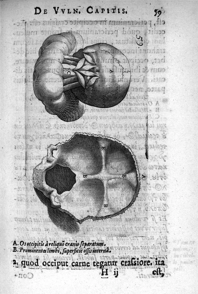 An illustration from Petri Paaw Amsteldamensis Succenturiatus Anatomicus. continens Commentaria in Hippocratem, de Capitis Vulneribus. additae In aliquot Capita libri VIII C. Celsi Explicationes. Ad illustres, Nobiles, Praepotentes, ac verè Magnifices Hollandiae Westfrisiaeque Ordines., 1616, leaf 68